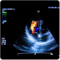 fetal-heart-echocardiogram